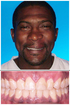Mckinney Orthodontics After 9
